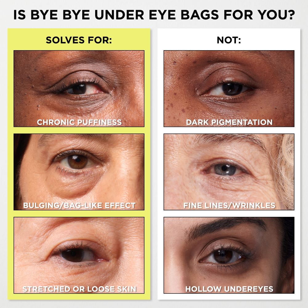 Bye Bye Under Eye Bags Daytime Treatment