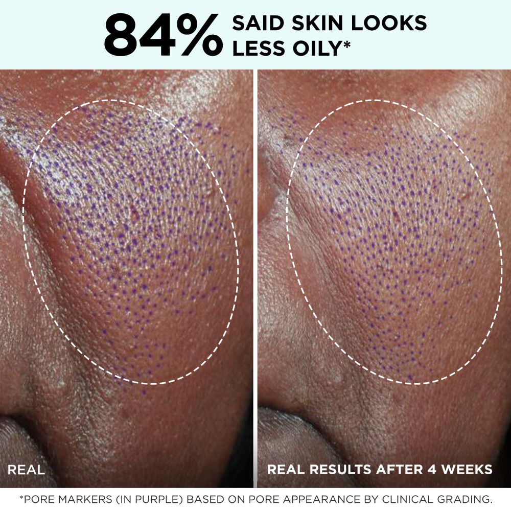 Confidence in a Gel Cream Oil-Free Moisturizer