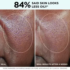 Confidence in a Gel Cream Oil-Free Moisturizer
