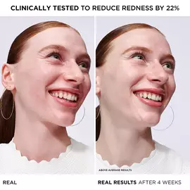 Bye Bye Redness Serum