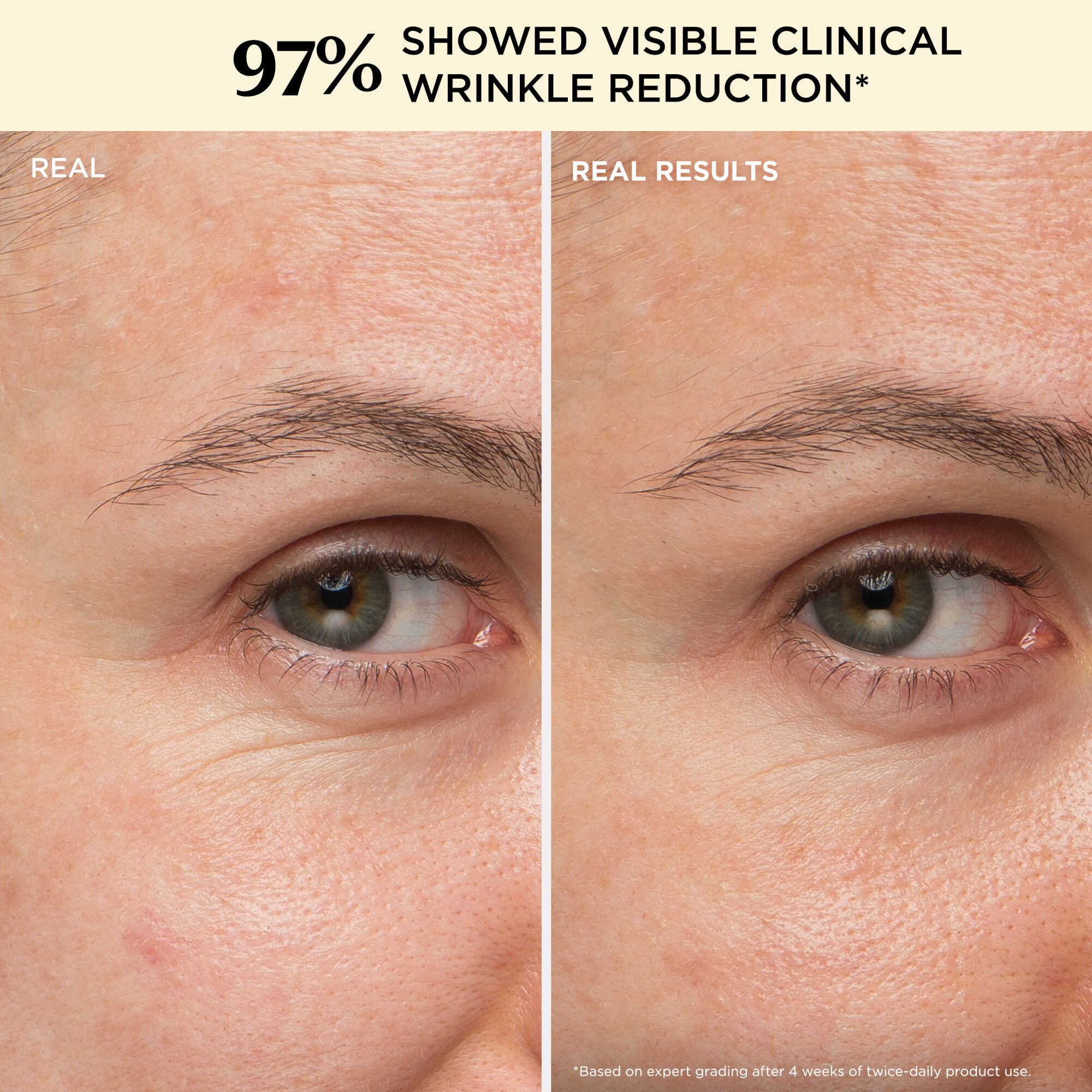 Confidence in a Cream Anti-Aging Hydrating Moisturizer