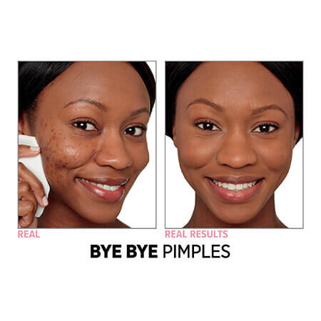 Bye Bye Foundation Oil-Free Matte Full Coverage Moisturizer™ with SPF 50+