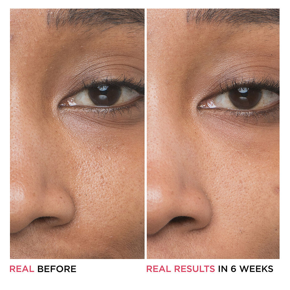 Glycolic acid 2025 for face