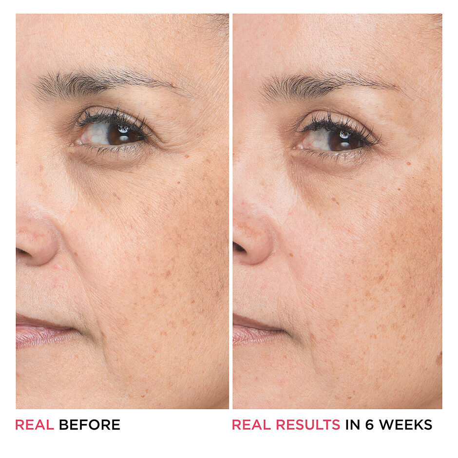 Bye Bye Lines Hyaluronic Acid Serum