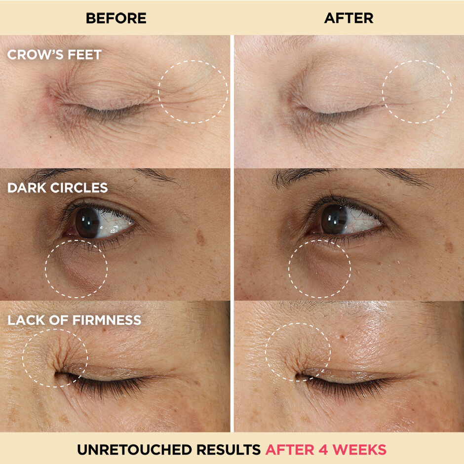 Peptide sales eye cream