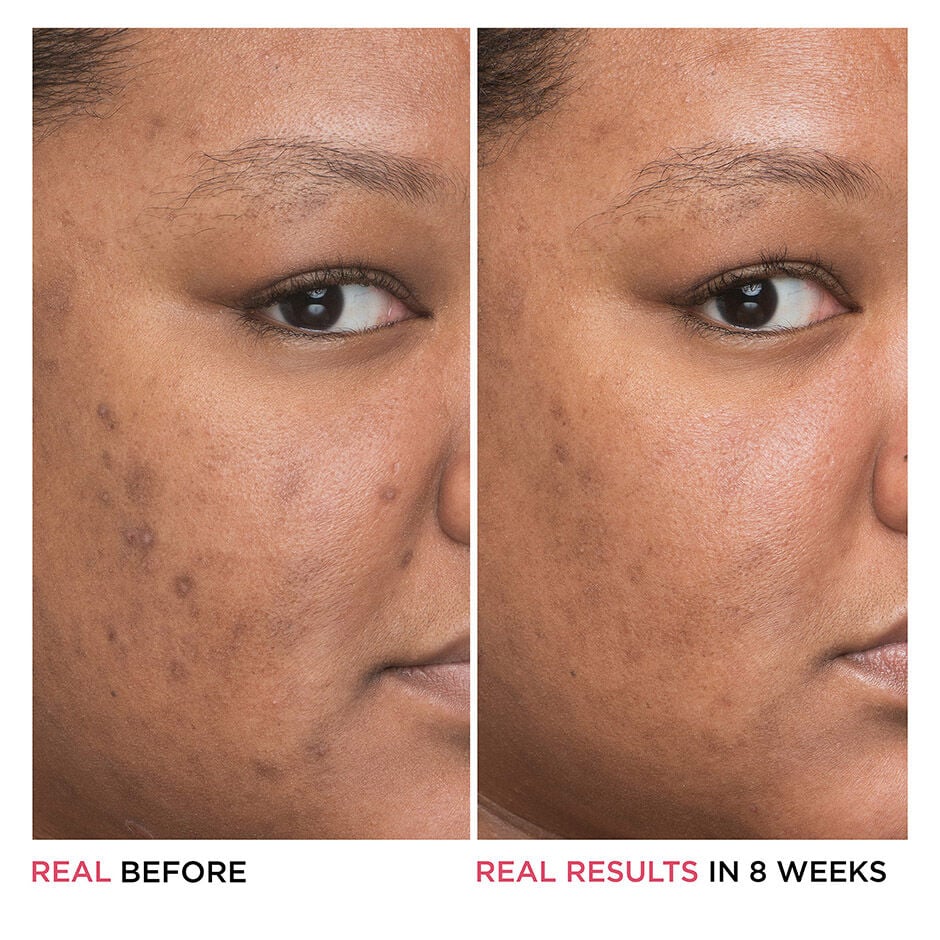 Bye Bye Dark Spots Niacinamide Serum It Cosmetics