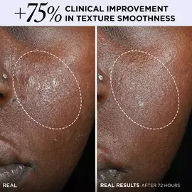 Confidence in a Cream® Barrier Boost Skin Barrier Repair Daily Moisturizer