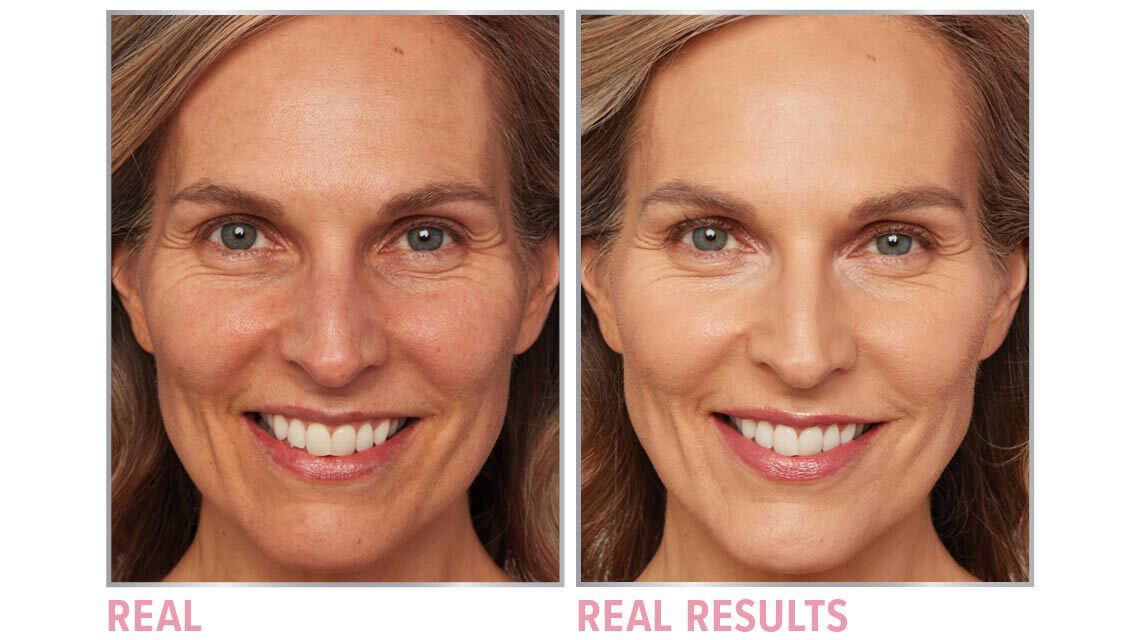 Product before image