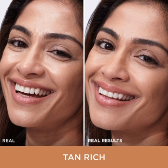 improved skin texture