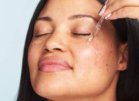 10 Reasons Why You Should Add Niacinamide To Your Skincare Routine