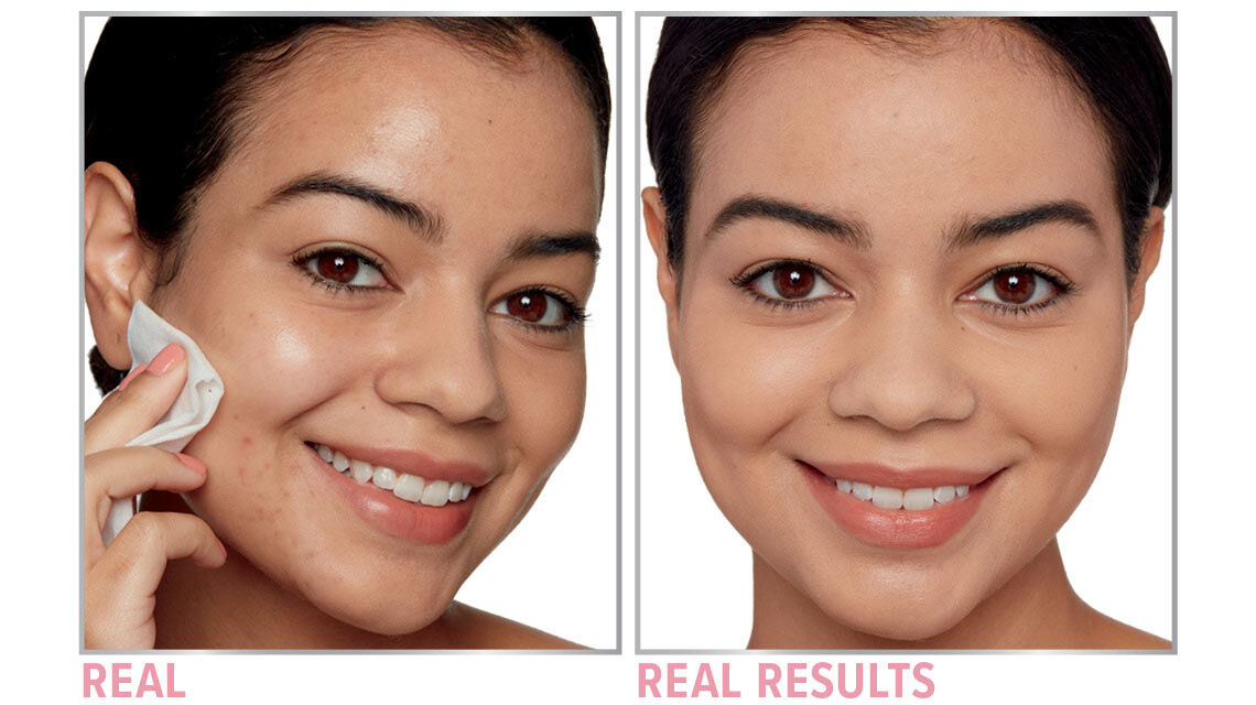 Product before image