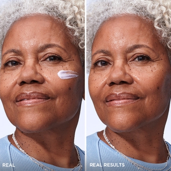 PLUMPER SKIN IN 1 WEEK**