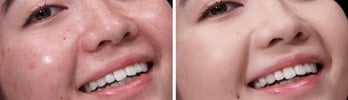 LESS VISIBLE SHINE*