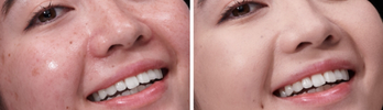 LESS VISIBLE SHINE*