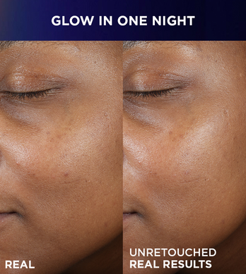 Before and After - Glow after 1 Night