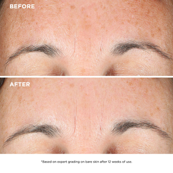 Step 1 - Tap to conceal