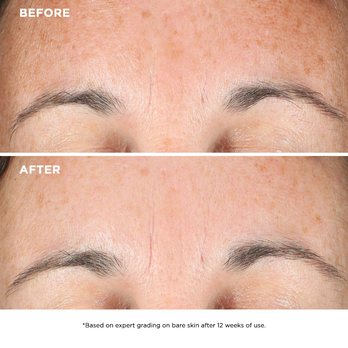 Step 1 - Tap to conceal