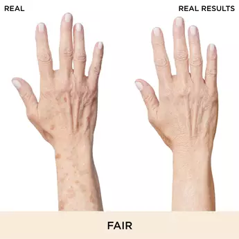 BEFORE AND AFTER