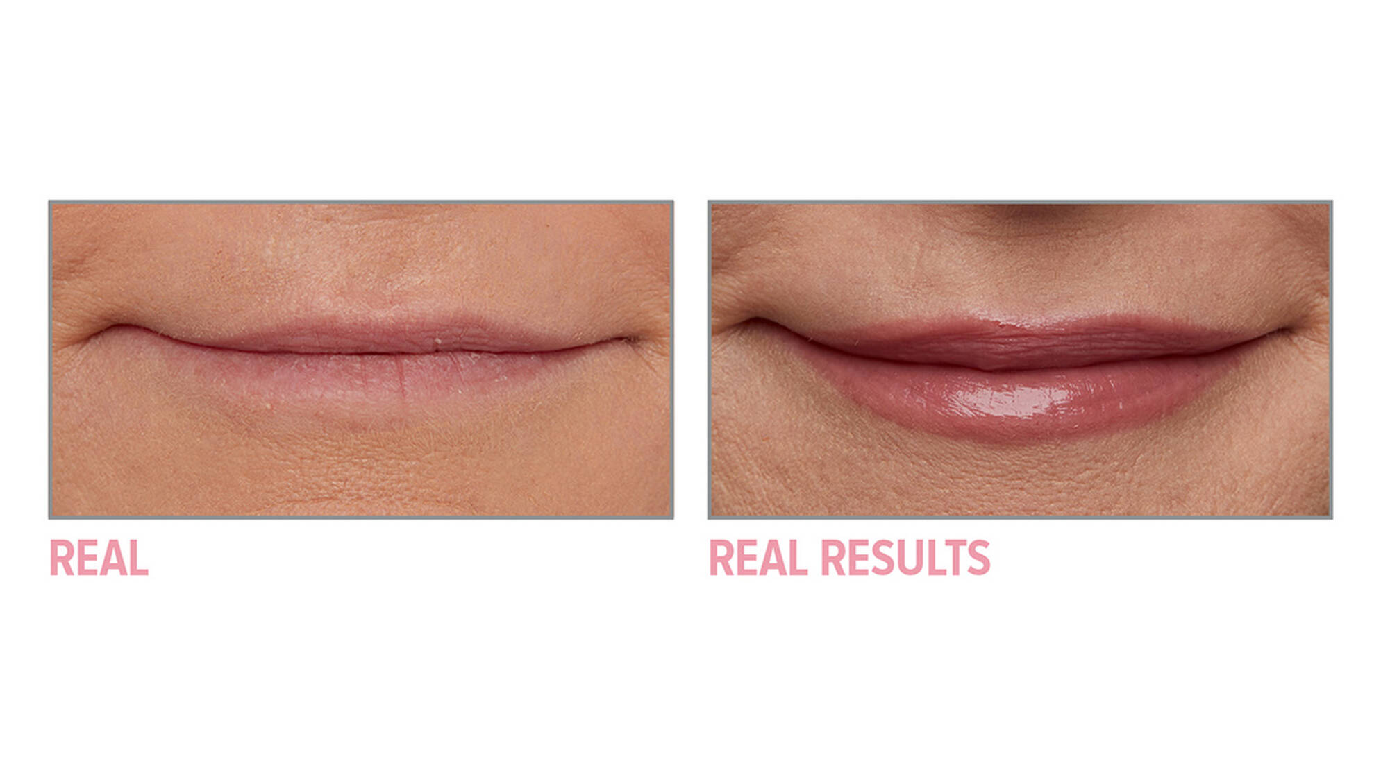 Pillow Lips Solid Serum Lip Gloss IT Cosmetics