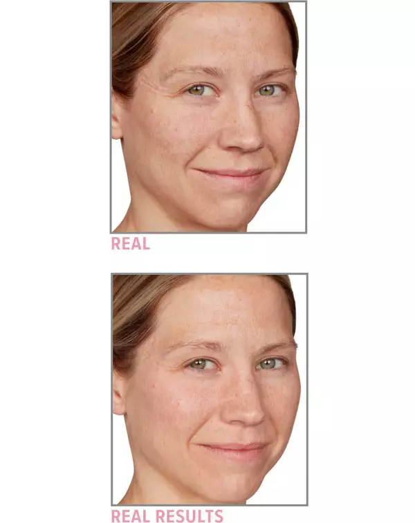 Side by side image showing before and after results