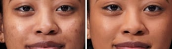 improved skin texture