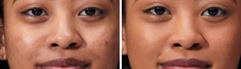 improved skin texture
