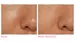 Product before image