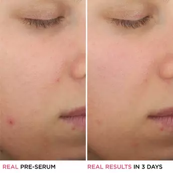 BEFORE AND AFTER