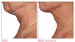 Product before image