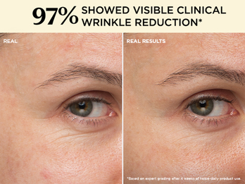97% showed visible clinical wrinkle reduction