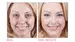 Product before image