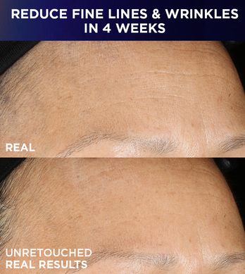 reduce fine lines and wrinkles in 4 weeks 