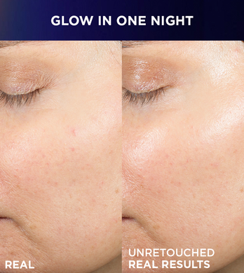 Before and After - Glow after 1 Night
