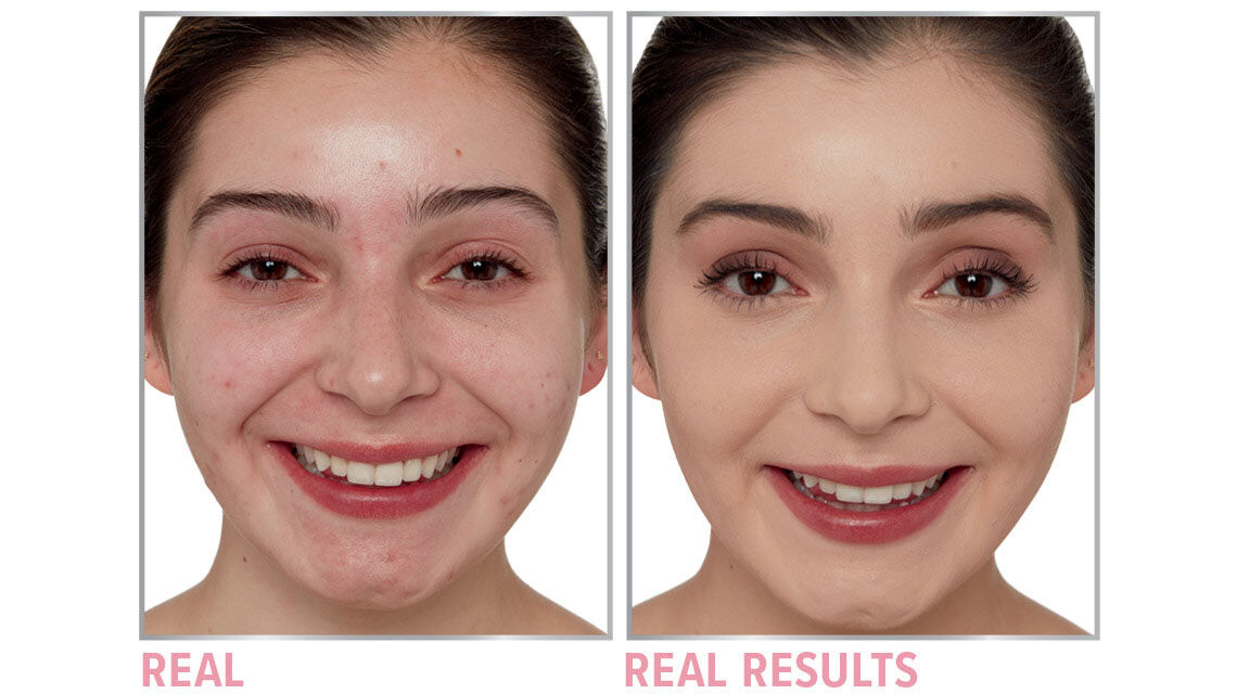 Product before image