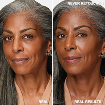 91% said skin texture is refined*