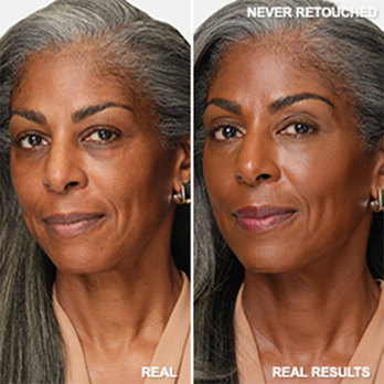 91% said skin texture is refined*