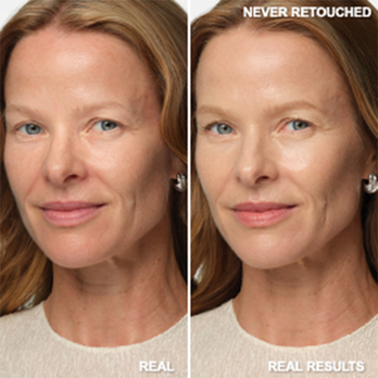 91% said skin texture is refined*