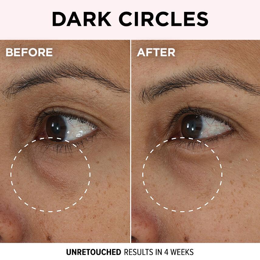 Eye cream before hot sale and after