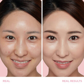 Side by side of woman smiling showing before and after results of skincare