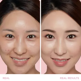 Side by side of woman smiling showing before and after results of skincare