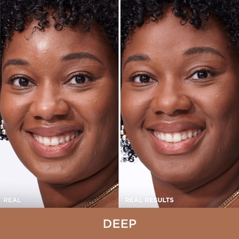 improved skin quality 