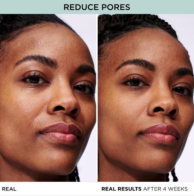 REDUCE PORES