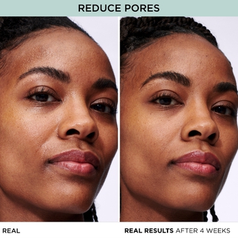 REDUCE PORES