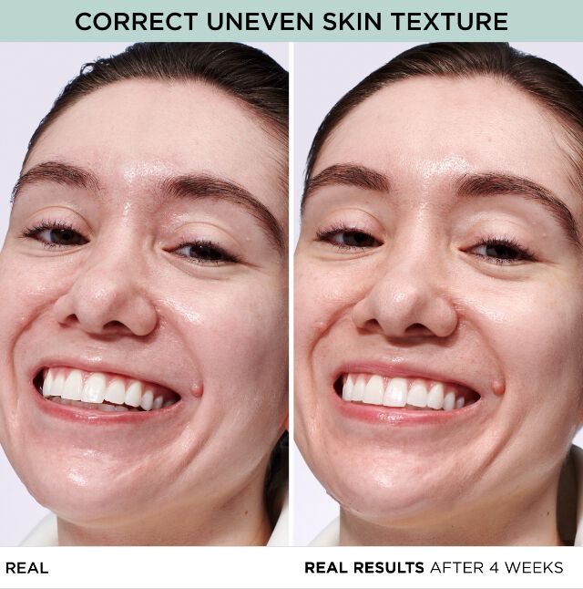 CORRECT UNEVEN SKIN TEXTURE