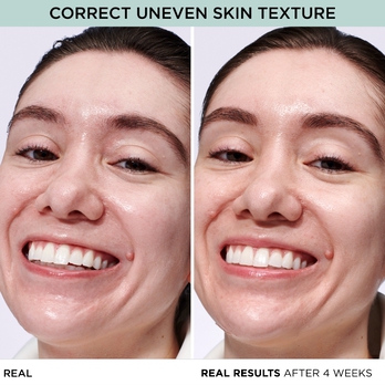 CORRECT UNEVEN SKIN TEXTURE