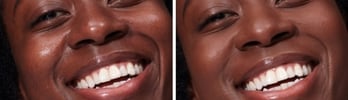 improved skin quality