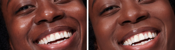 improved skin quality