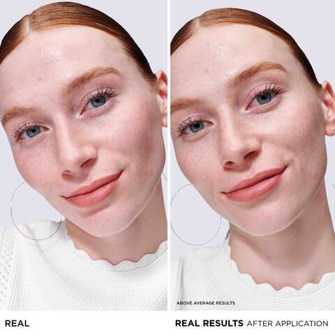 YOUR INSTANT REDNESS FIX