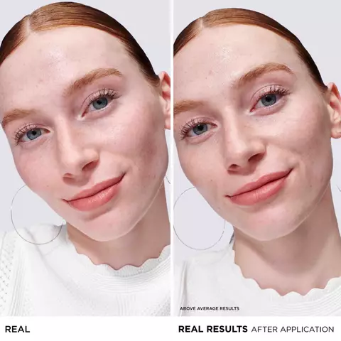 YOUR INSTANT REDNESS FIX