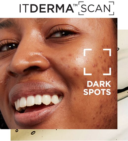 dermascan